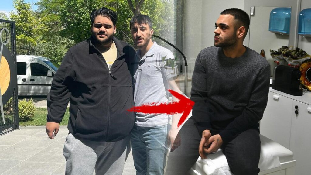 75 Kilo Verdi, Hayatını Değiştirdi! Hangi Yiyeceklerden Uzak Durmalı?