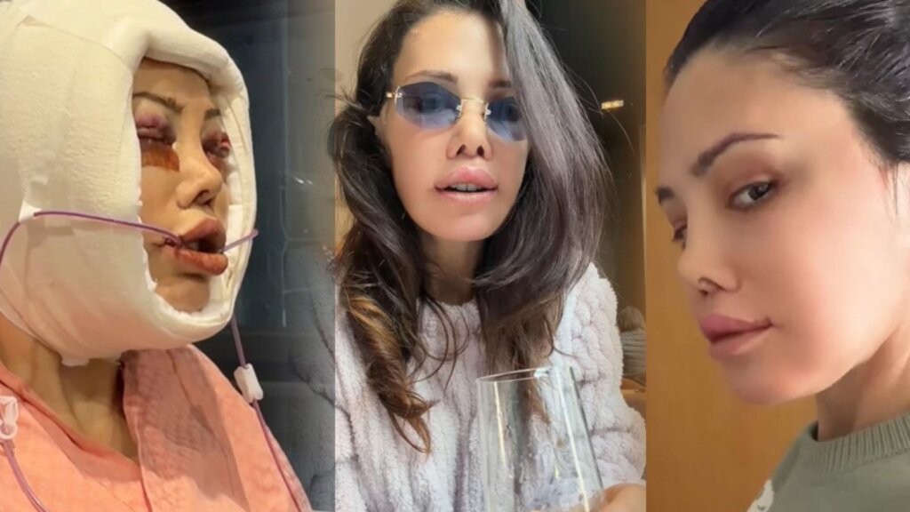 Didem Ceran, Kore’deki Yüz Naklinden Sonra Göğüs Kanseri Sürecini Duyurdu!